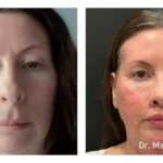Before&After_02