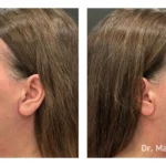 Before&After_03