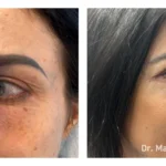 Before&After_04