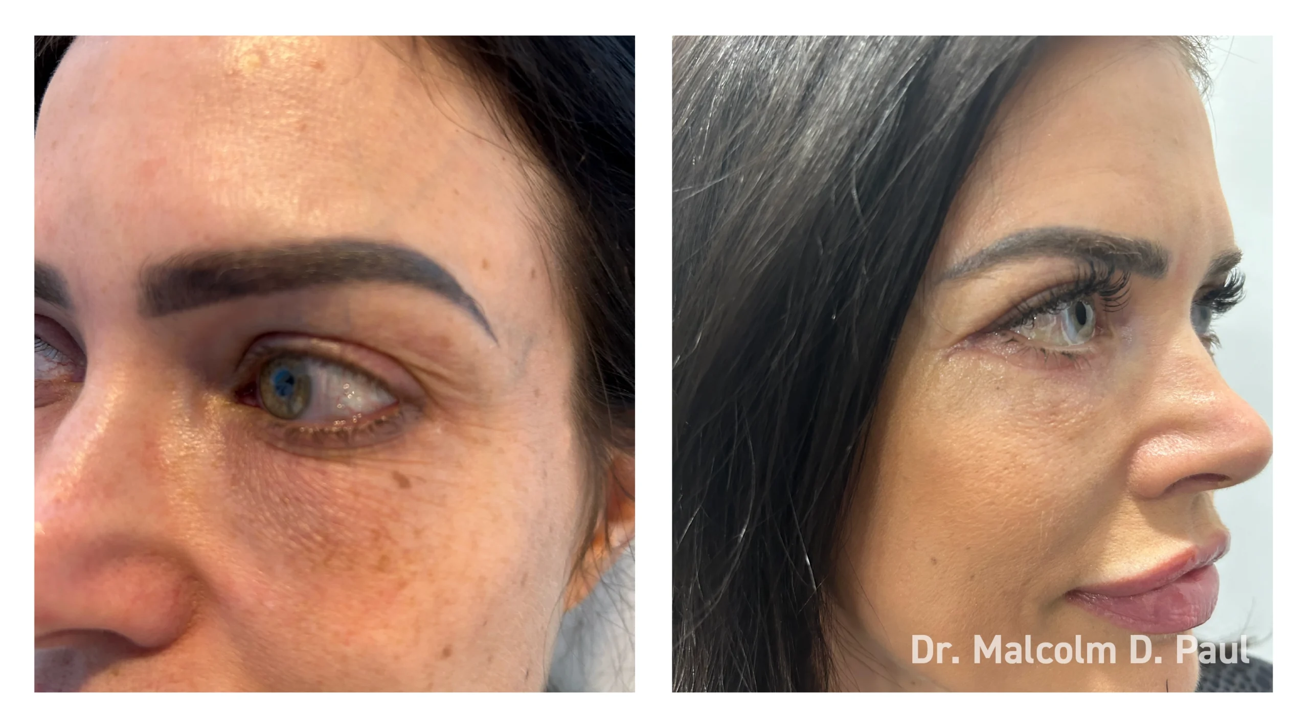 Before&After_04