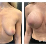 Before&After_05