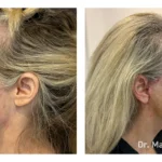 Before&After_08