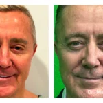 Before&After_09