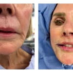 Before&After_10