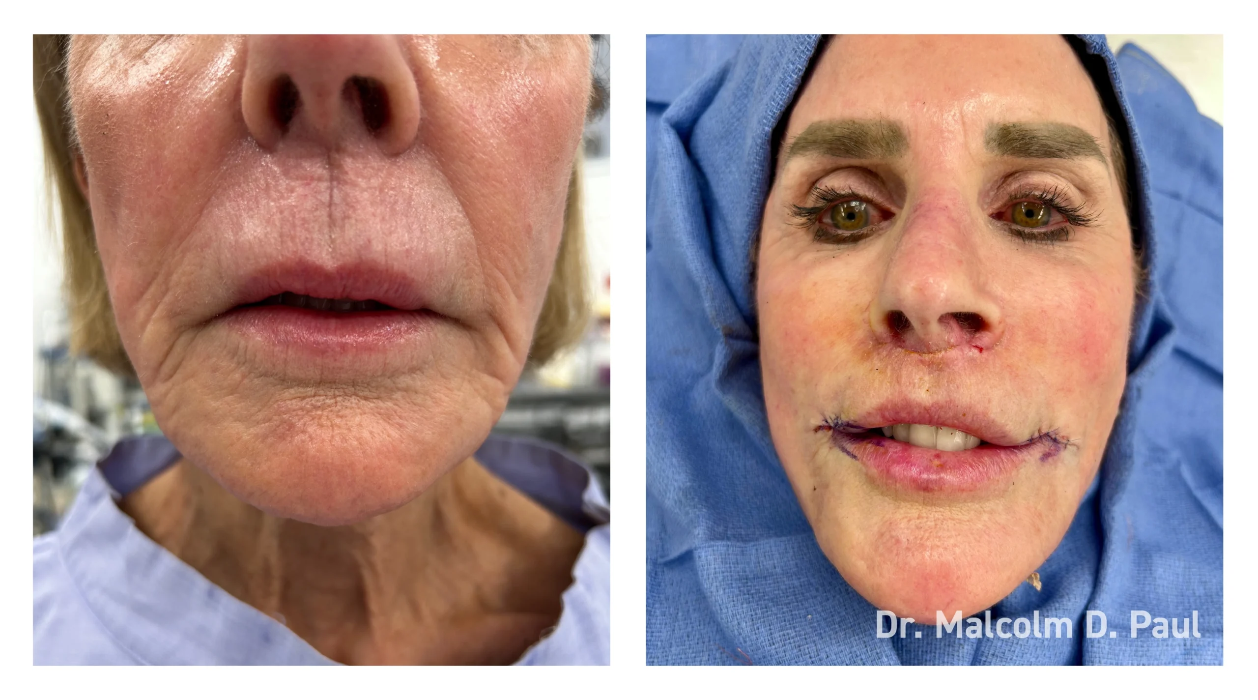 Before&After_10