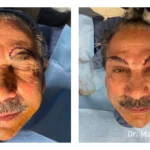 Before&After_11