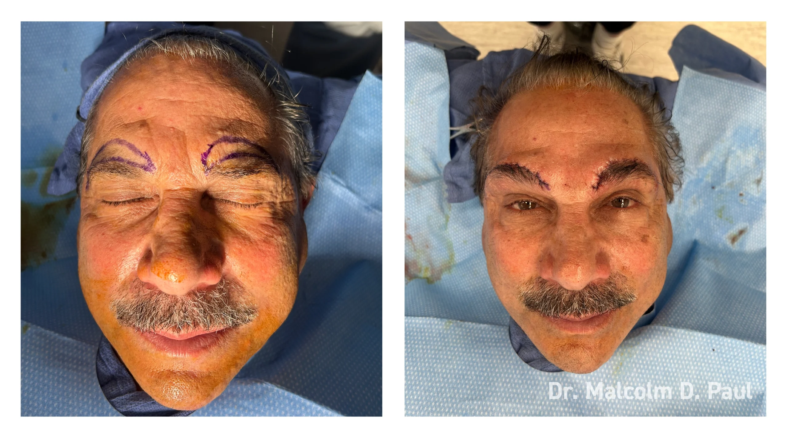 Before&After_11