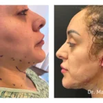 Before&After_12