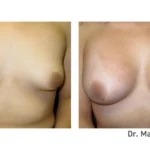 Before&After_13