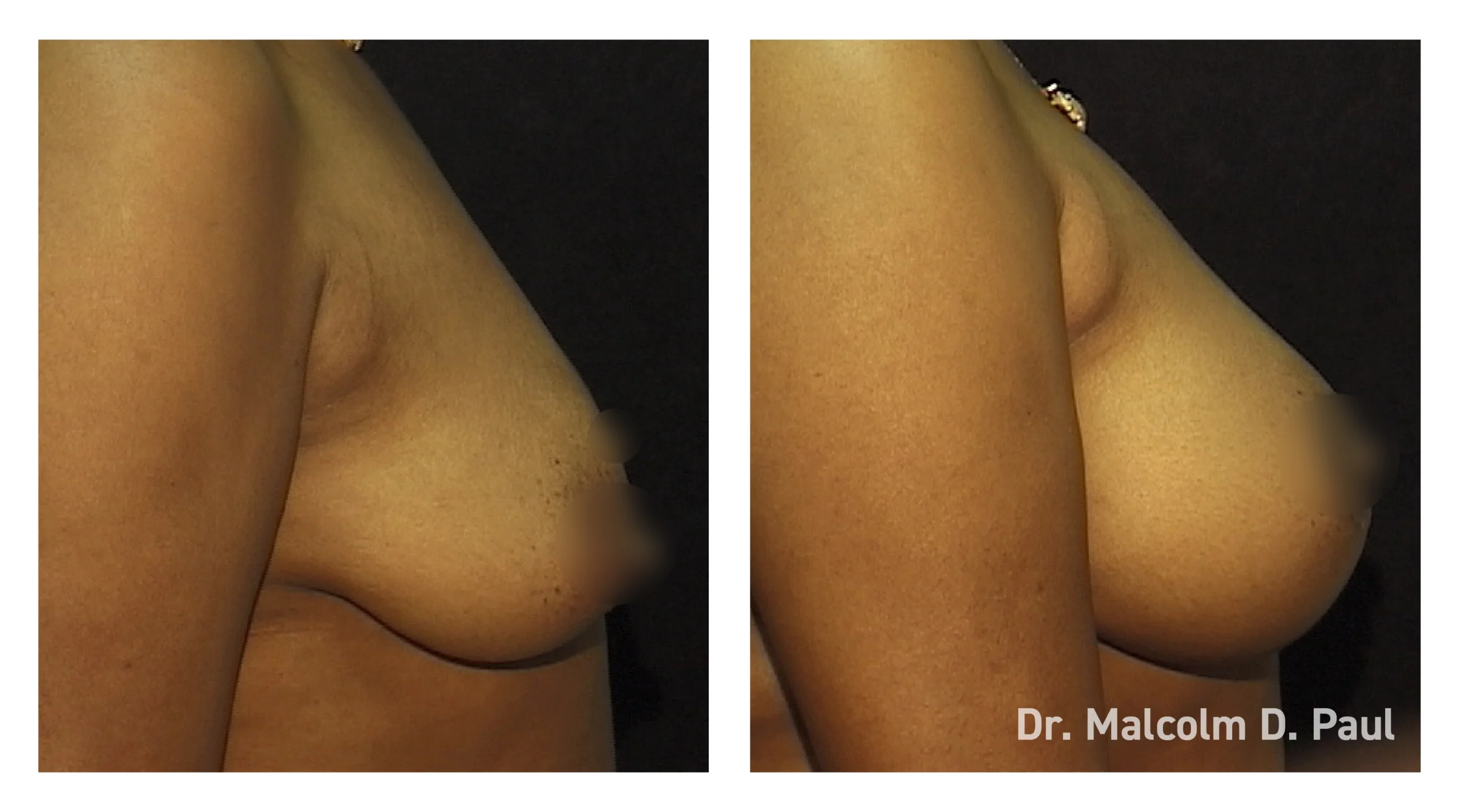 Before&After_14