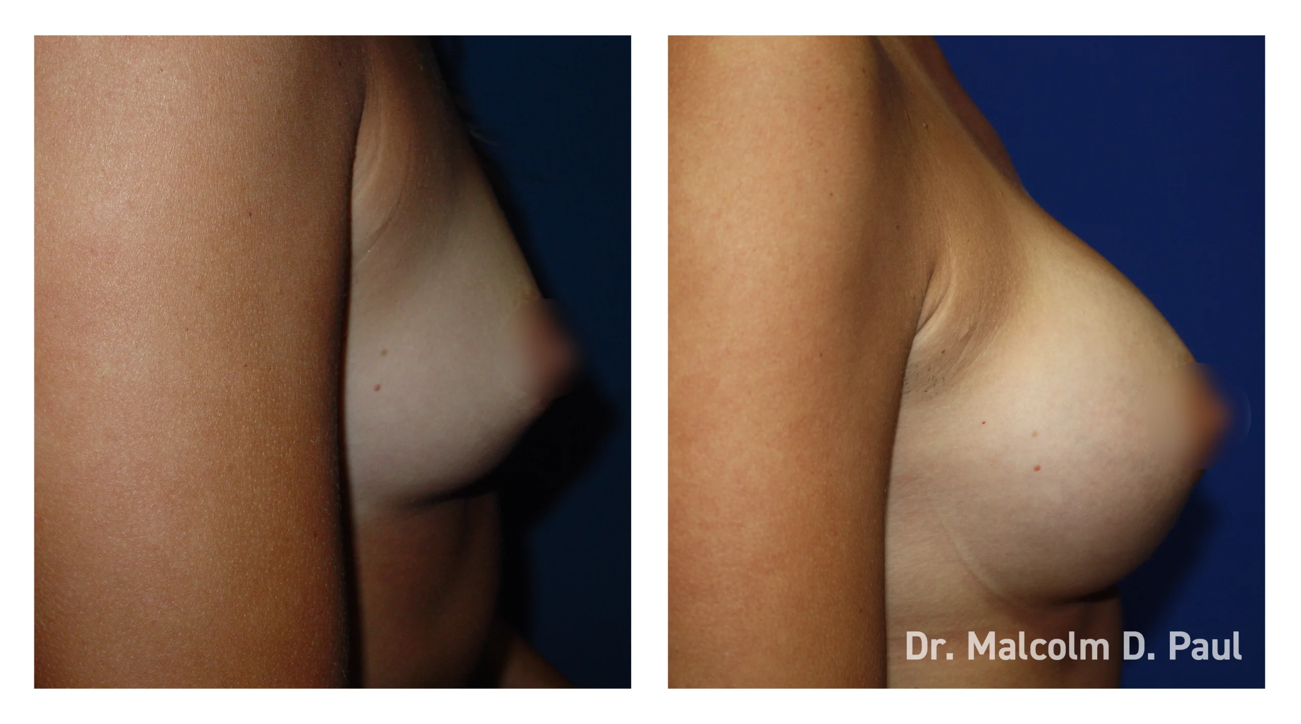 Before&After_15