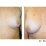 Before&After_16