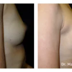 Before&After_18